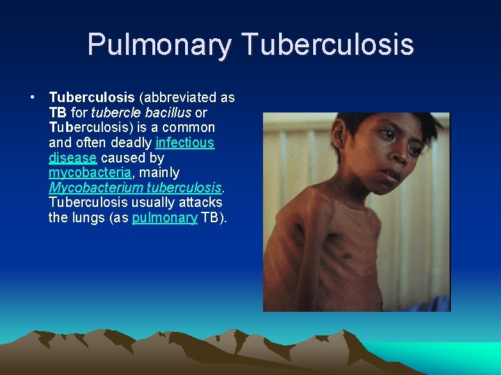 Pulmonary Tuberculosis • Tuberculosis (abbreviated as TB for tubercle bacillus or Tuberculosis) is a