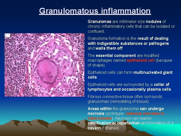 Granulomatous inflammation Granulomas are millimeter size nodules of chronic inflammatory cells that can be