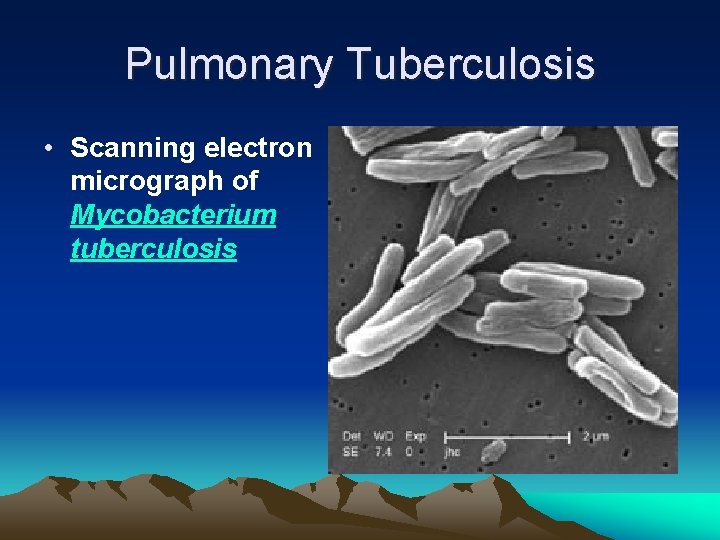 Pulmonary Tuberculosis • Scanning electron micrograph of Mycobacterium tuberculosis 