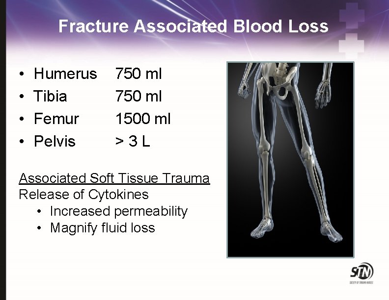 Fracture Associated Blood Loss • • Humerus Tibia Femur Pelvis 750 ml 1500 ml
