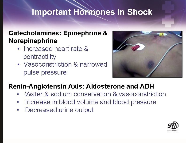 Important Hormones in Shock Catecholamines: Epinephrine & Norepinephrine • Increased heart rate & contractility