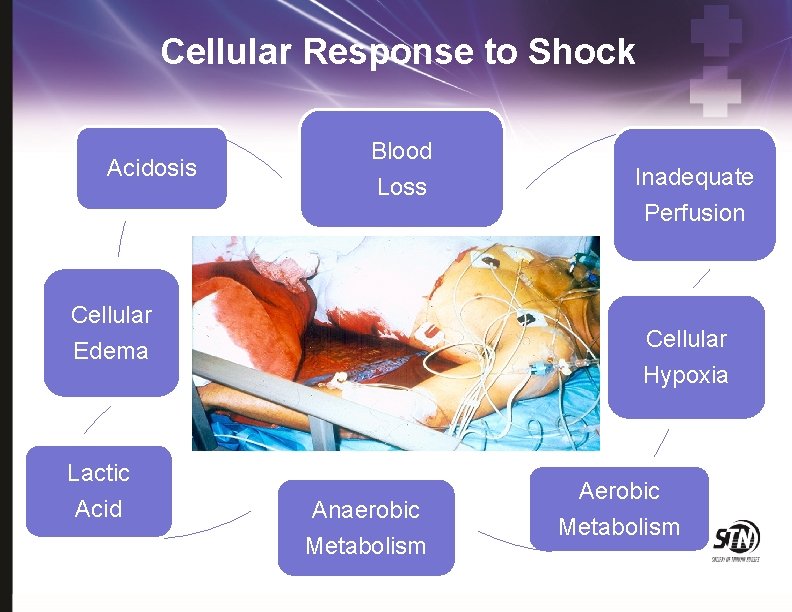 Cellular Response to Shock Acidosis Blood Loss Cellular Perfusion Cellular Edema Lactic Acid Inadequate