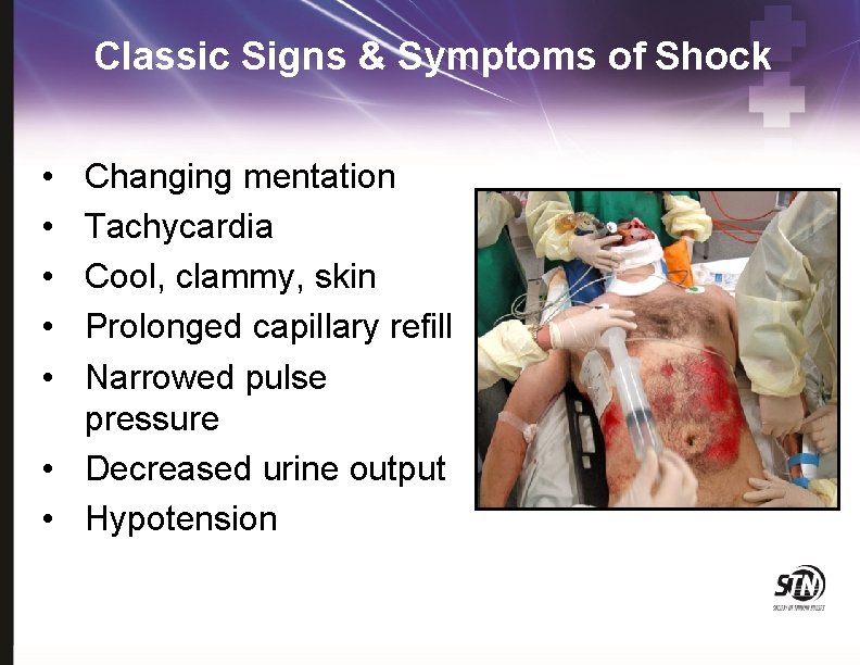 Classic Signs & Symptoms of Shock • • • Changing mentation Tachycardia Cool, clammy,