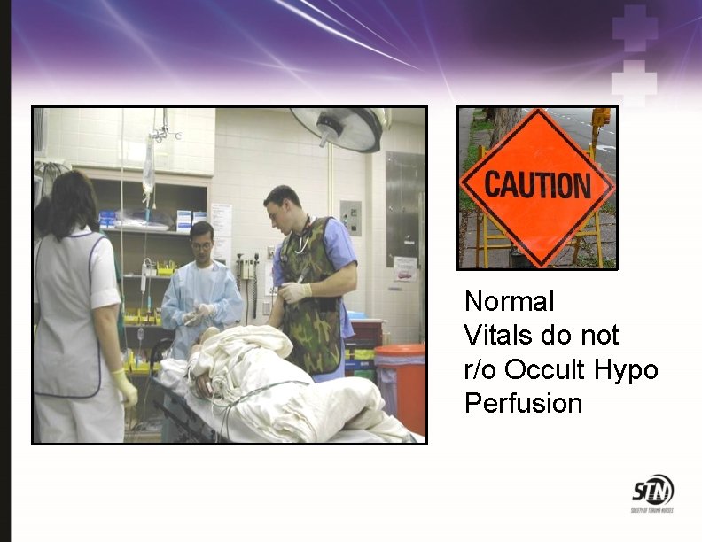 Normal Vitals do not r/o Occult Hypo Perfusion 