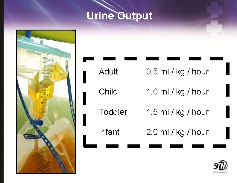 Urine Output Adult 0. 5 ml / kg / hour Child 1. 0 ml