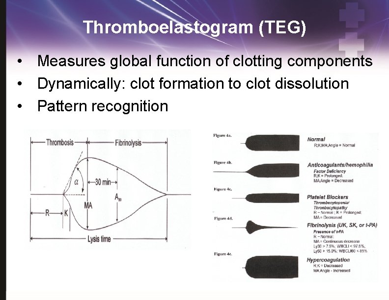 Thromboelastogram (TEG) • Measures global function of clotting components • Dynamically: clot formation to