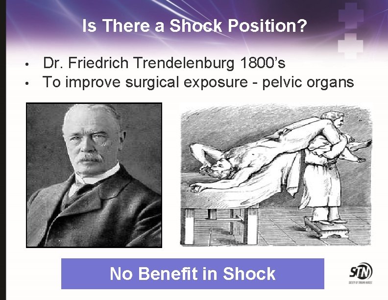 Is There a Shock Position? • • Dr. Friedrich Trendelenburg 1800’s To improve surgical