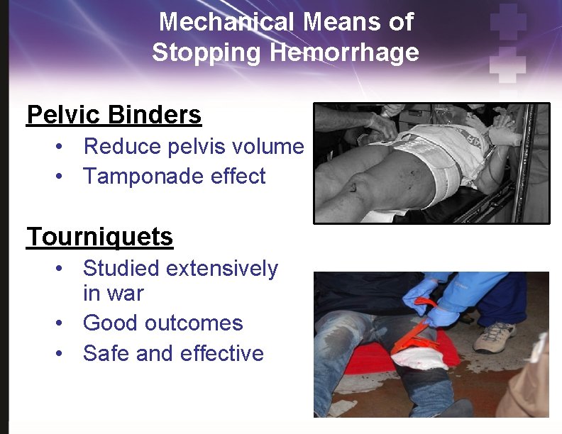 Mechanical Means of Stopping Hemorrhage Pelvic Binders • Reduce pelvis volume • Tamponade effect