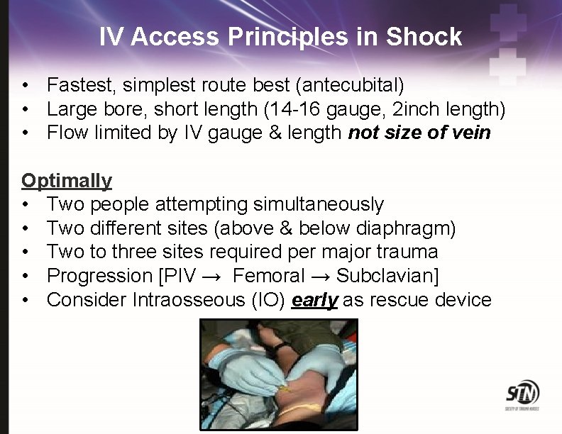 IV Access Principles in Shock • Fastest, simplest route best (antecubital) • Large bore,