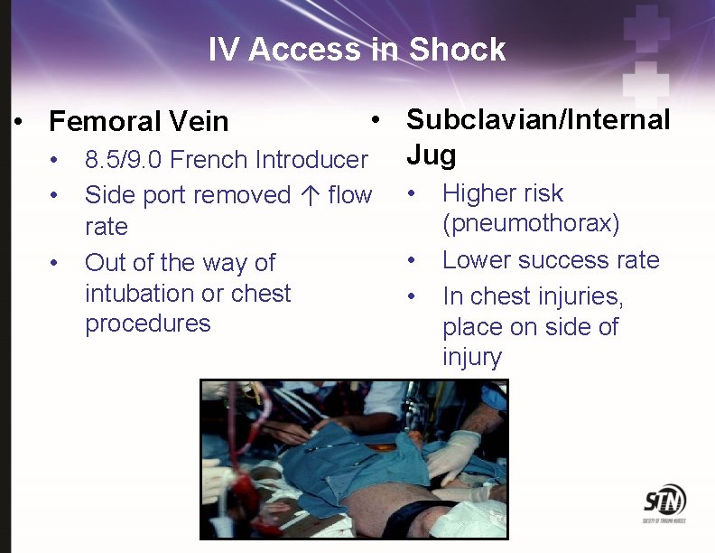 IV Access in Shock • Subclavian/Internal • 8. 5/9. 0 French Introducer Jug •