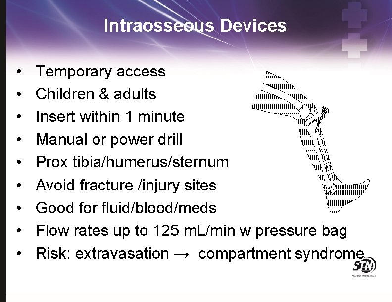 Intraosseous Devices • • • Temporary access Children & adults Insert within 1 minute