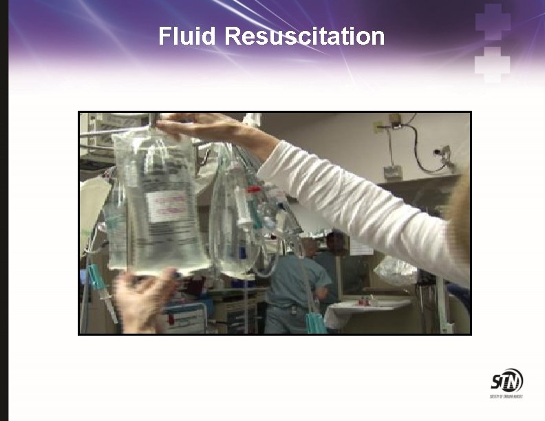 Fluid Resuscitation 