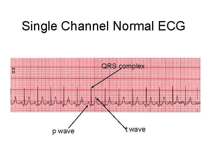 Single Channel Normal ECG QRS complex p wave t wave 