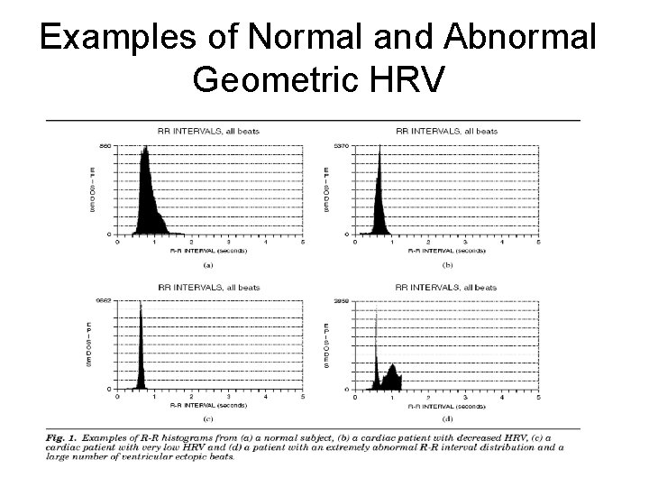 Examples of Normal and Abnormal Geometric HRV 
