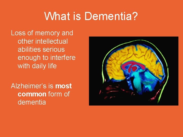 What is Dementia? Loss of memory and other intellectual abilities serious enough to interfere