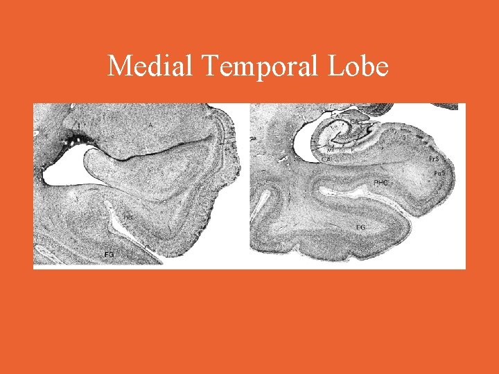 Medial Temporal Lobe 