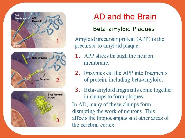 AD and the Brain Beta-amyloid Plaques 1. Amyloid precursor protein (APP) is the precursor