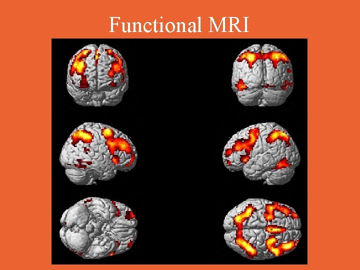 Functional MRI 