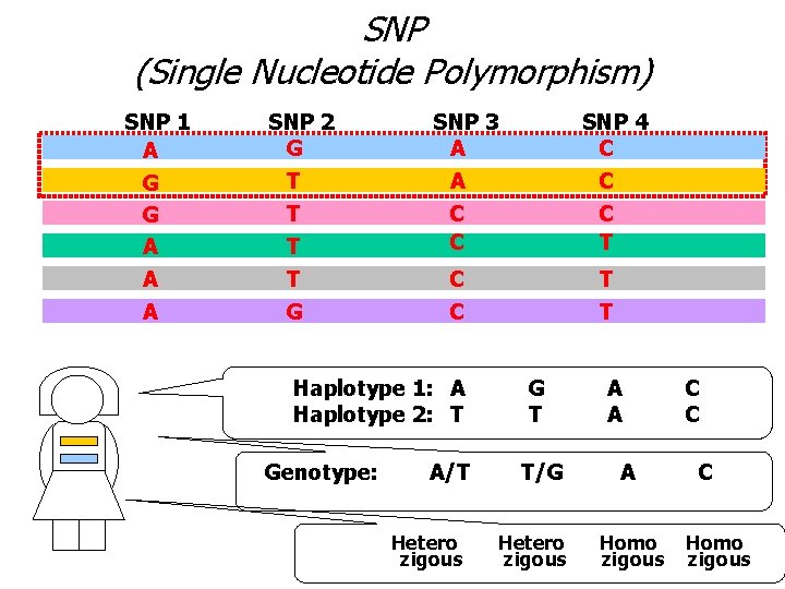 SNP (Single Nucleotide Polymorphism) SNP 1 A G G A A A SNP 2