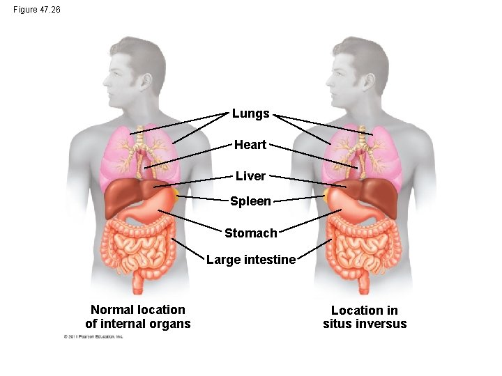 Figure 47. 26 Lungs Heart Liver Spleen Stomach Large intestine Normal location of internal