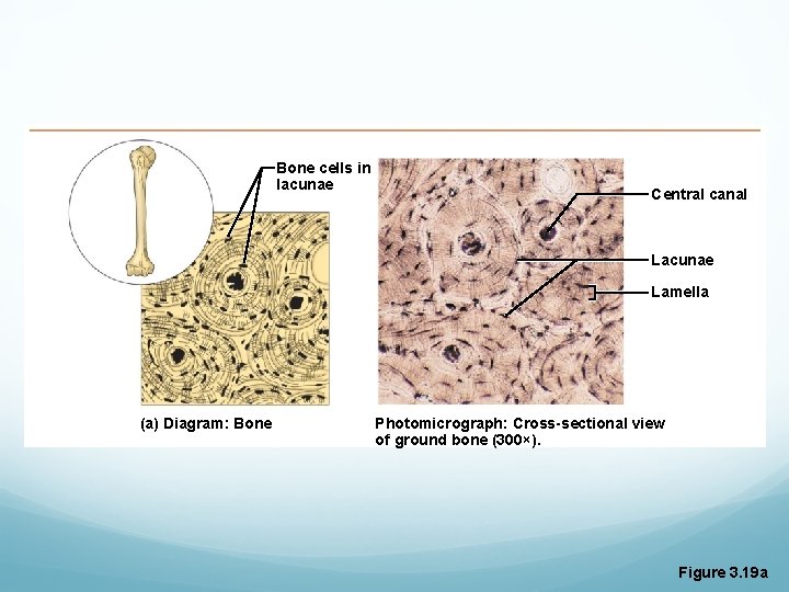 Bone cells in lacunae Central canal Lacunae Lamella (a) Diagram: Bone Photomicrograph: Cross-sectional view Bone cells in lacunae Central canal Lacunae Lamella (a) Diagram: Bone Photomicrograph: Cross-sectional view