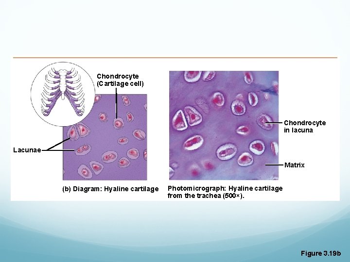Chondrocyte (Cartilage cell) Chondrocyte in lacuna Lacunae Matrix (b) Diagram: Hyaline cartilage Photomicrograph: Hyaline Chondrocyte (Cartilage cell) Chondrocyte in lacuna Lacunae Matrix (b) Diagram: Hyaline cartilage Photomicrograph: Hyaline