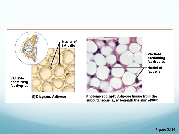 Nuclei of fat cells Vacuole containing fat droplet (f) Diagram: Adipose Photomicrograph: Adipose tissue Nuclei of fat cells Vacuole containing fat droplet (f) Diagram: Adipose Photomicrograph: Adipose tissue