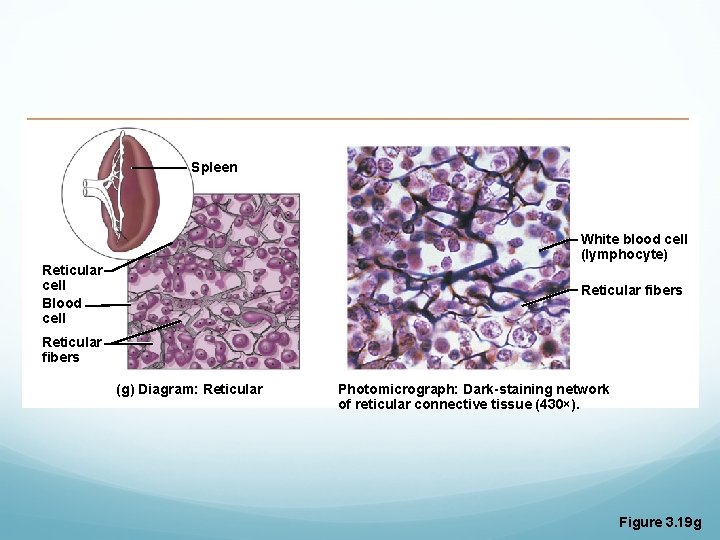 Spleen White blood cell (lymphocyte) Reticular cell Blood cell Reticular fibers (g) Diagram: Reticular