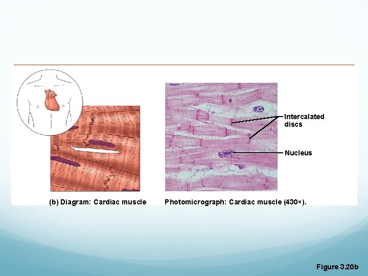 Intercalated discs Nucleus (b) Diagram: Cardiac muscle Photomicrograph: Cardiac muscle (430×). Figure 3. 20 Intercalated discs Nucleus (b) Diagram: Cardiac muscle Photomicrograph: Cardiac muscle (430×). Figure 3. 20