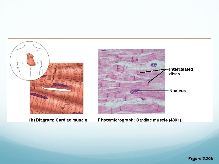 Intercalated discs Nucleus (b) Diagram: Cardiac muscle Photomicrograph: Cardiac muscle (430×). Figure 3. 20