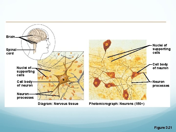 Brain Nuclei of supporting cells Spinal cord Cell body of neuron Nuclei of supporting