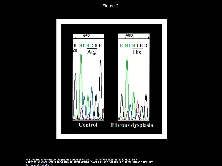 Figure 2 The Journal of Molecular Diagnostics 2000 267 -72 DOI: (10. 1016/S 1525
