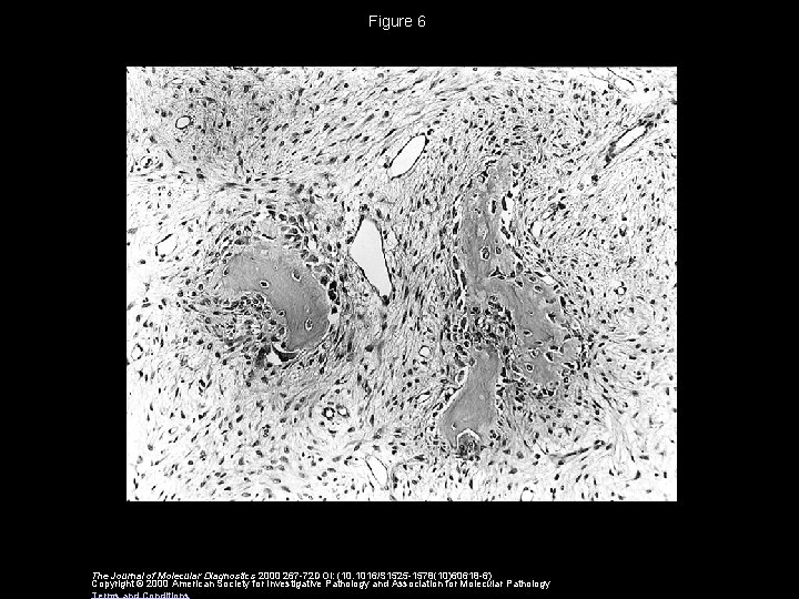 Figure 6 The Journal of Molecular Diagnostics 2000 267 -72 DOI: (10. 1016/S 1525