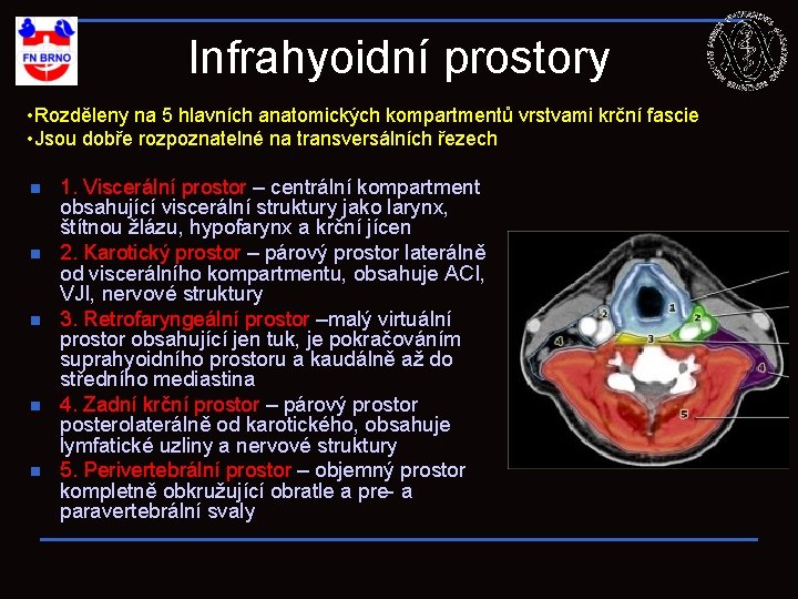 Infrahyoidní prostory • Rozděleny na 5 hlavních anatomických kompartmentů vrstvami krční fascie • Jsou