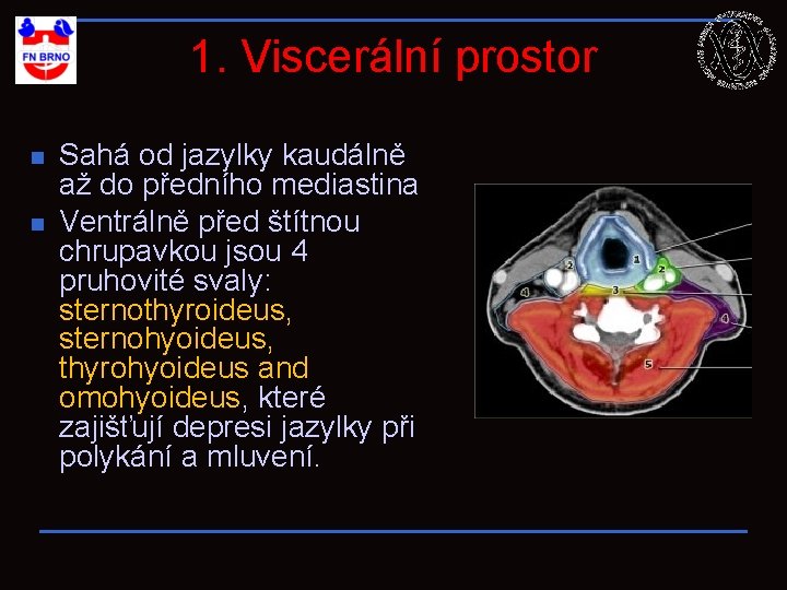 1. Viscerální prostor n n Sahá od jazylky kaudálně až do předního mediastina Ventrálně