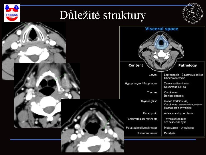 Důležité struktury 