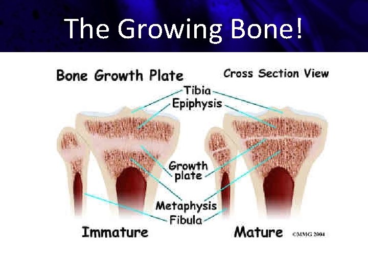 The Growing Bone! 