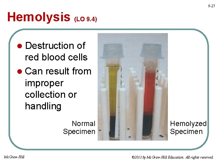 9 -27 Hemolysis (LO 9. 4) l Destruction of red blood cells l Can