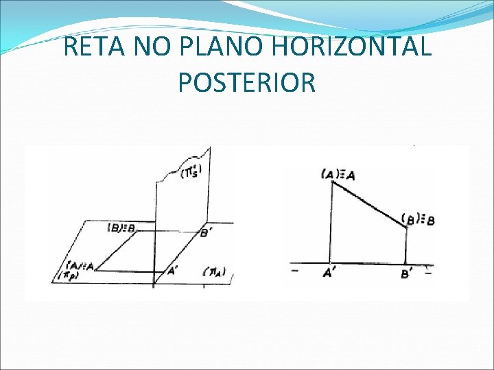 RETA NO PLANO HORIZONTAL POSTERIOR  RETA NO PLANO HORIZONTAL POSTERIOR