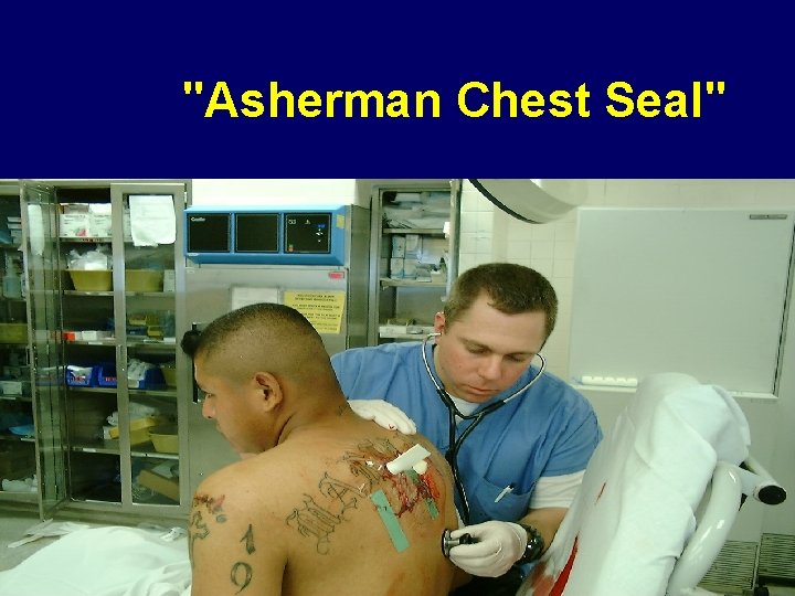 "Asherman Chest Seal" 