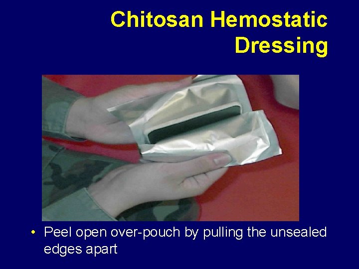 Chitosan Hemostatic Dressing • Peel open over-pouch by pulling the unsealed edges apart 