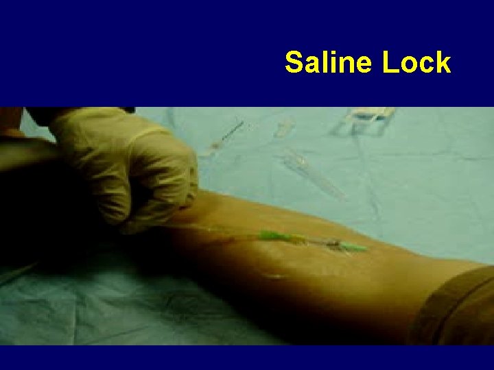 Saline Lock 