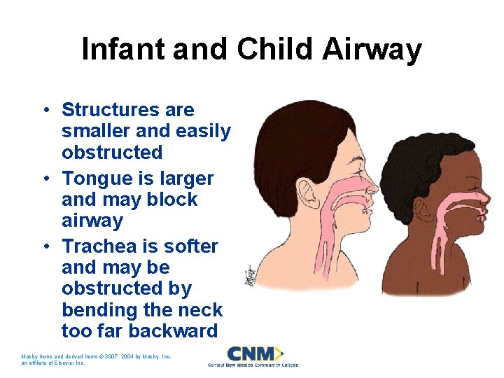 Infant and Child Airway • Structures are smaller and easily obstructed • Tongue is