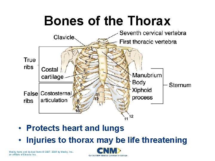 Bones of the Thorax • Protects heart and lungs • Injuries to thorax may