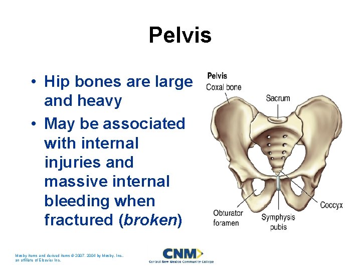 Pelvis • Hip bones are large and heavy • May be associated with internal