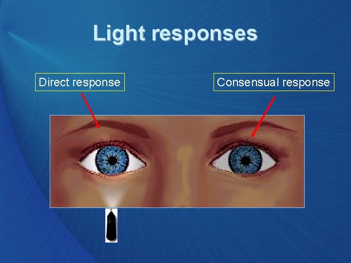 Light responses Direct response Consensual response 