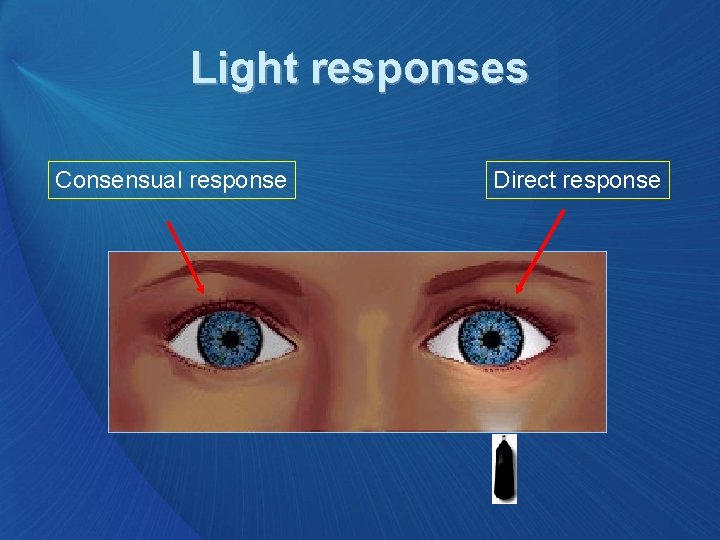 Light responses Consensual response Direct response 