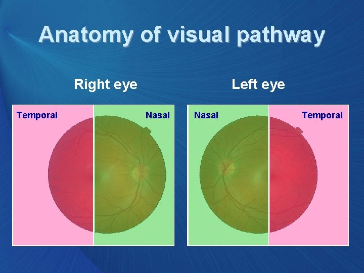 Anatomy of visual pathway Right eye Temporal Left eye Nasal Temporal 