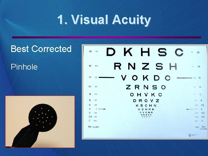 1. Visual Acuity Best Corrected Pinhole 