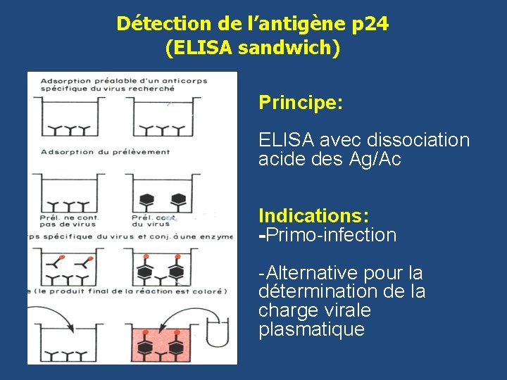 Détection de l’antigène p 24 (ELISA sandwich) Principe: ELISA avec dissociation acide des Ag/Ac